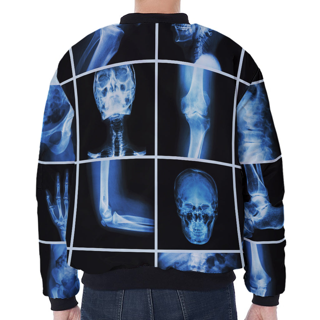 X-Ray Film Radiology Print Zip Sleeve Bomber Jacket